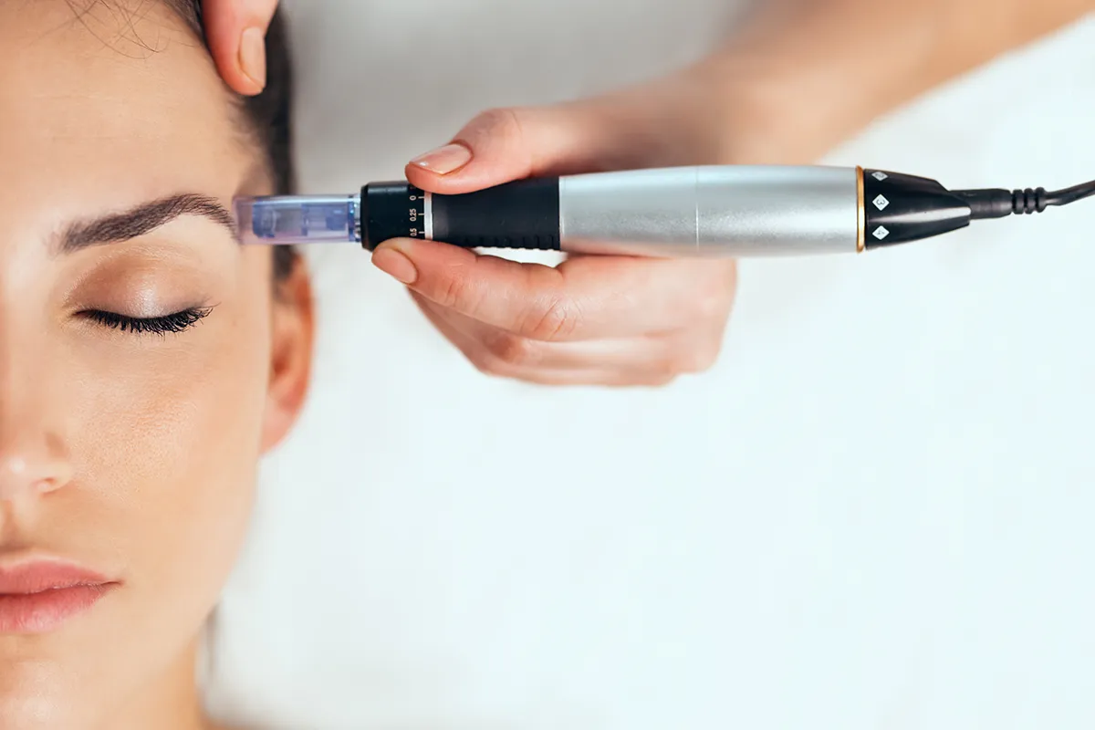 microneedling au centre esthétique Roosevelt