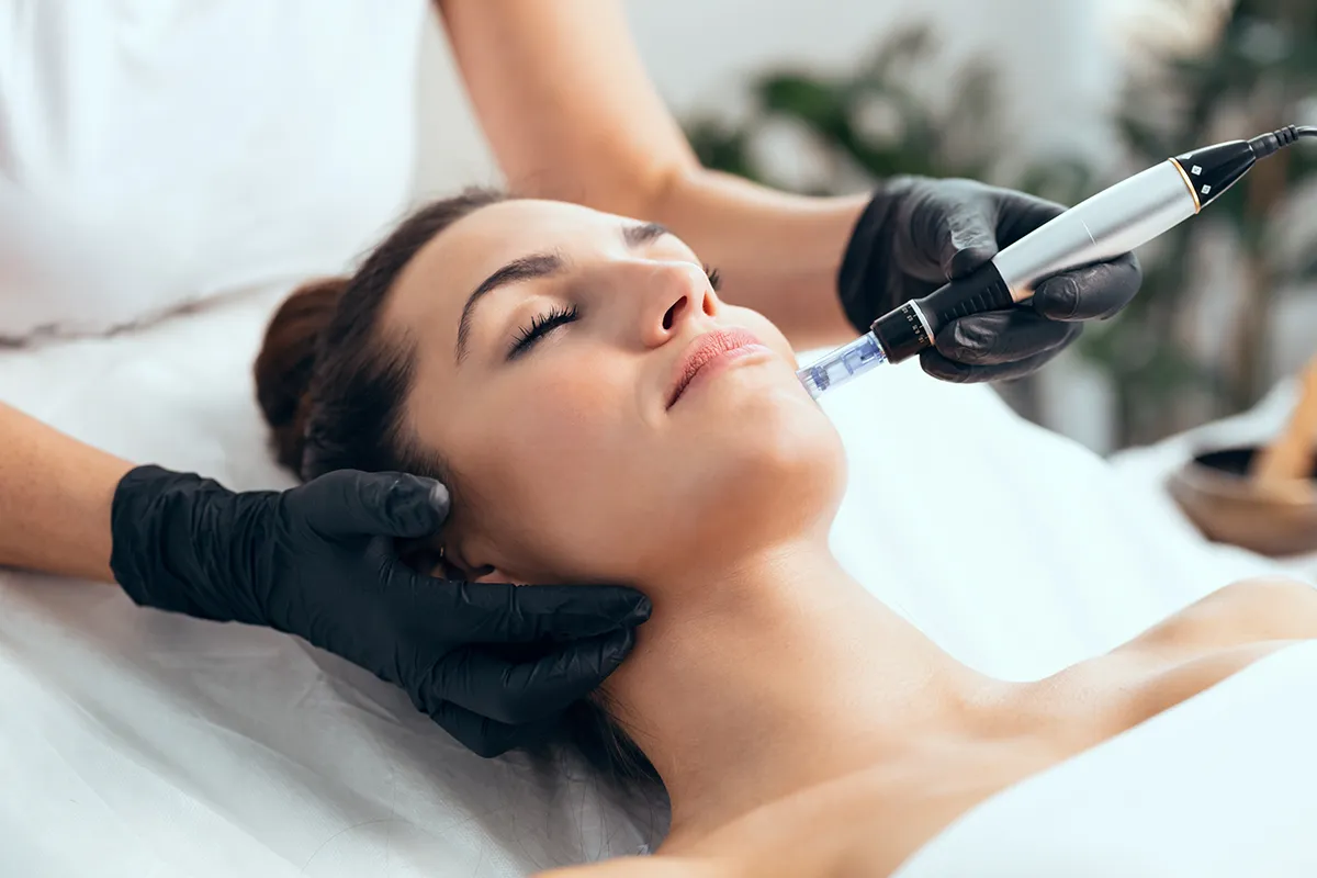 Soin esthétique du visage par microneedling ou radiofréquence pour améliorer la qualité et la fermeté de la peau.