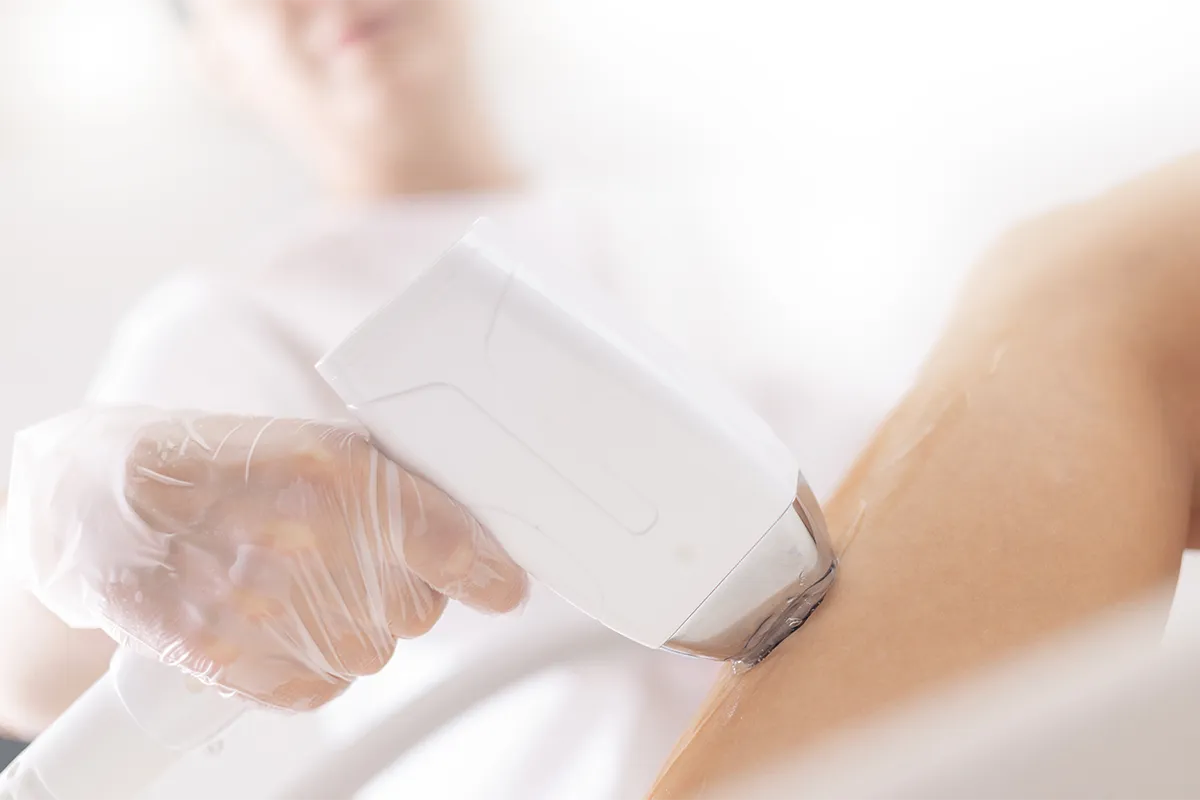 Épilation électrique ou laser : comment choisir ?