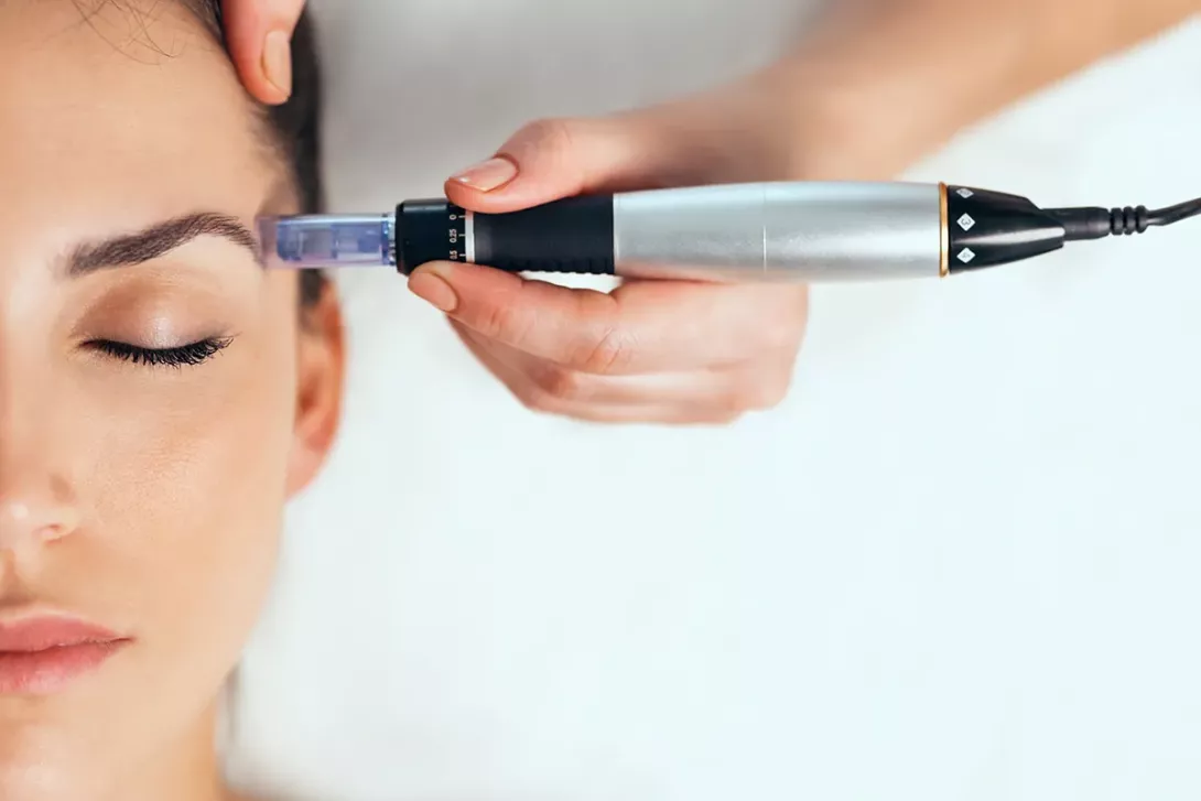 microneedling au centre esthétique Roosevelt